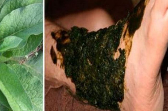 Cara menggunakan daun salam untuk mengatasi kembung